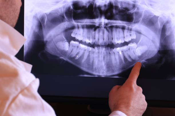 Best Emergency Root Canal Treatment in Deer Park, IL